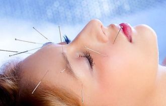 5 problemas de beleza que podem ser tratados com acupuntura