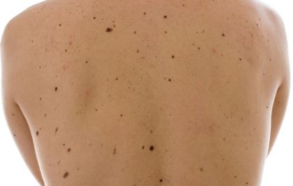 Doenças de pele: 5 sintomas e sinais que merecem atenção